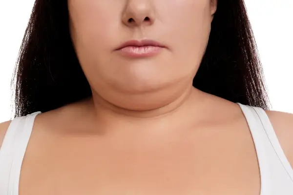 하루만에 얼굴살 빼는 법, 얼굴 붓기도 한번에 빼기